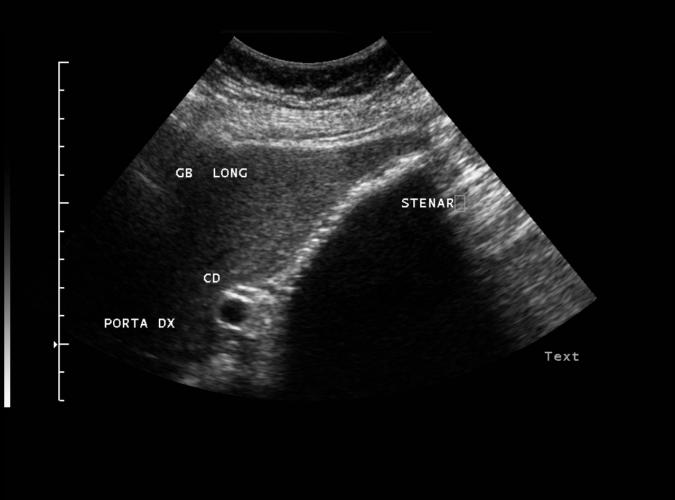 2 av  Catherine Olsson, sonograf